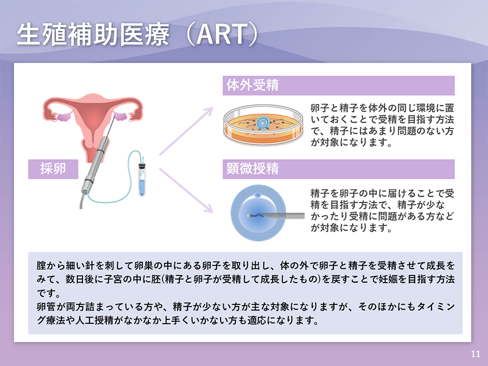 生殖補助医療（ART）